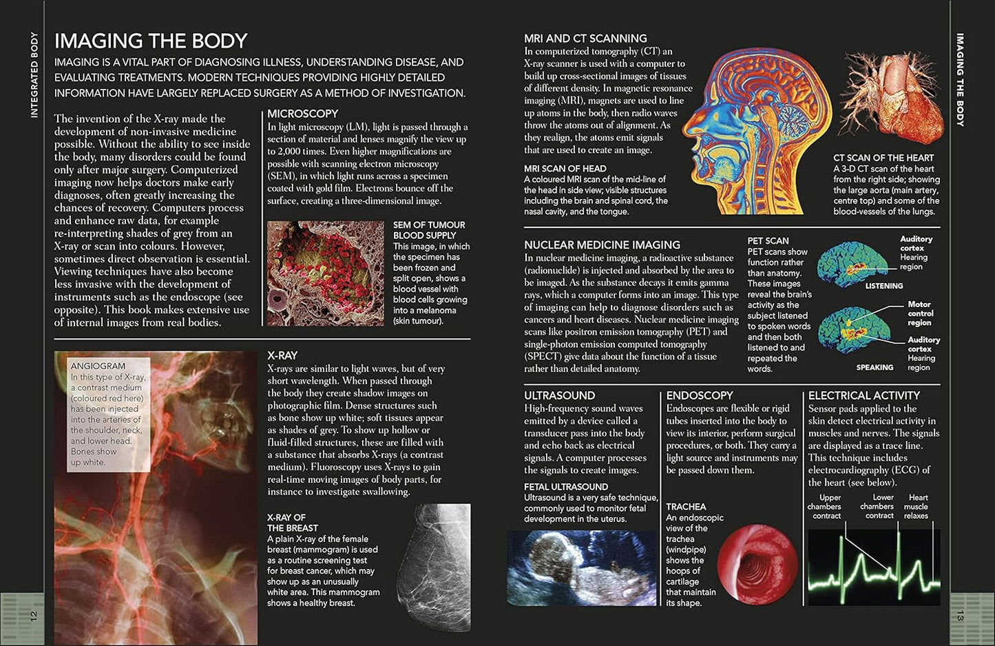 The Concise Human Body Book: An illustrated guide to its structure, function and disorders - DK Human Body Guides (Paperback)
