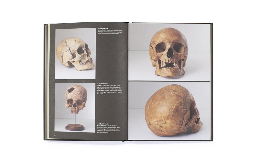 Skulls: Portraits of the Dead and the Stories They Tell (Hardback)